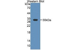 Figure. (ABCB4 anticorps  (AA 1034-1276))