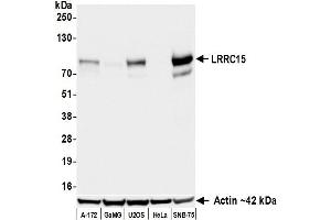 Western Blotting (WB) image for anti-Leucine Rich Repeat Containing 15 (LRRC15) (AA 22-538) antibody (ABIN7795791)