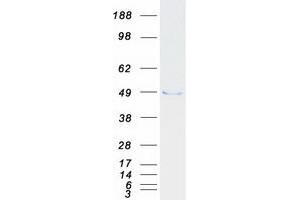 Validation with Western Blot