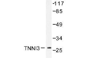 Image no. 1 for anti-Cardiac Troponin I (TNNI3) antibody (ABIN271939) (TNNI3 anticorps)