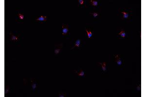 ABIN6266637 staining A549 cells by IF/ICC.