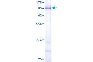 Image no. 1 for Copine III (CPNE3) (AA 1-537) protein (GST tag) (ABIN1350204)