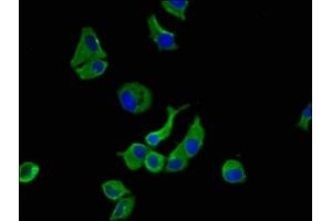 Immunofluorescence staining of MCF-7 cells with ABIN7175658 at 1:100, counter-stained with DAPI. (SORCS1 anticorps  (AA 34-175))