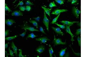 Immunofluorescence staining of U251 cells with ABIN7139928 at 1:100, counter-stained with DAPI.
