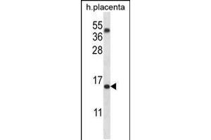 Western blot analysis in human placenta tissue lysates (35ug/lane). (TM4SF18 anticorps  (AA 113-141))