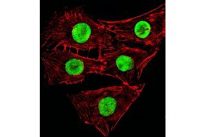 Fluorescent image of C2C12cells stained with Mouse Hmga2 Antibody (C-term) (ABIN6243227 and ABIN6577673).