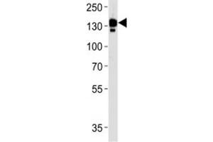 Ceruloplasmin antibody western blot analysis in human blood plasma lysate.