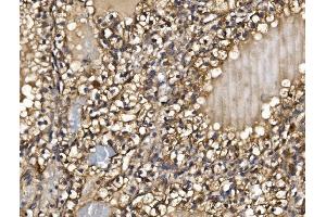 IHC analysis of PMPCA/INPP5 using anti-PMPCA/INPP5 antibody (ABIN7602722). (PMPCA anticorps  (AA 99-525))