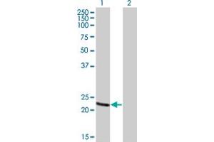 Western Blot analysis of RCV1 expression in transfected 293T cell line by RCV1 monoclonal antibody (M01), clone 4C6.