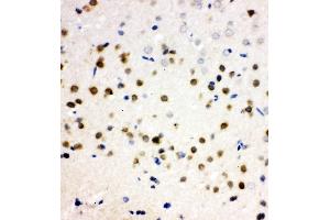 Anti-PLK2 antibody, IHC(P) IHC(P): Rat Brain Tissue (PLK2 anticorps  (C-Term))