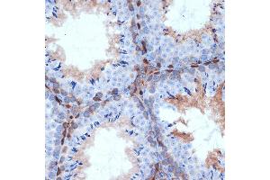 Immunohistochemistry of paraffin-embedded mouse testis using PKC delta Rabbit mAb  at dilution of 1:100 (40x lens). (PKC delta anticorps)
