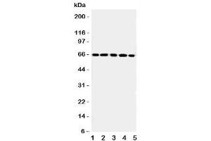 Western blot testing of RGS14 antibody and Lane 1:  rat thymus (RGS14 anticorps  (C-Term))
