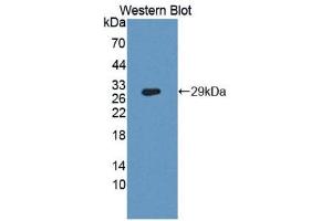 Western Blotting (WB) image for anti-Dipeptidyl-Peptidase 4 (DPP4) (AA 484-728) antibody (ABIN3207613) (DPP4 anticorps  (AA 484-728))