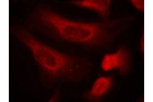 Immunofluorescence staining of methanol-fixed Hela cells using STAT1(Phospho-Ser727) Antibody.