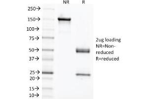 SDS-PAGE Analysis Purified CEA Mouse Monoclonal Antibody (C66/1291). (CEACAM5 anticorps)