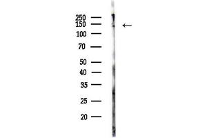 Western blot analysis of lysates from Rat brain, using NACAD Antibody at 1/1000 dilution.