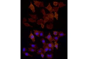 Immunofluorescence analysis of  cells using CD146/MCAM Rabbit pAb (ABIN6127568, ABIN6143621, ABIN6143622 and ABIN6218100) at dilution of 1:50 (40x lens). (MCAM anticorps  (AA 447-646))