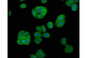 Immunofluorescence staining of HepG2 cells with ABIN7145910 at 1:66, counter-stained with DAPI. (APOBEC1 anticorps  (AA 1-172))