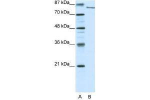 FBXL11 antibody used at 0. (KDM2A anticorps  (N-Term))