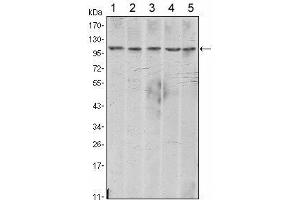 Western Blot showing CDH2 antibody used against A431 (1), NIH/3T3 (2), Hela (3), C6 (4) and LNCap (5) cell lysate. (N-Cadherin anticorps)