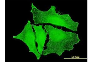 Immunofluorescence of monoclonal antibody to PKP4 on HeLa cell.
