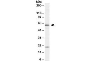 Western blot testing of HeLa cell lysate with BMPR1A antibody at 1ug/ml. (BMPR1A anticorps)