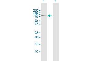 Western Blot analysis of CACNB1 expression in transfected 293T cell line by CACNB1 MaxPab polyclonal antibody.