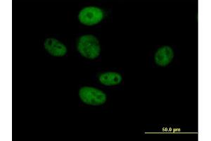 Immunofluorescence of purified MaxPab antibody to TLE3 on HeLa cell. (TLE3 anticorps  (AA 1-772))