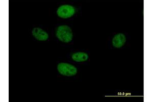 Immunofluorescence of purified MaxPab antibody to TLE3 on HeLa cell.