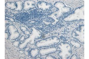 ABIN185470 Negative Control showing staining of paraffin embedded Human Prostate, with no primary antibody. (PLAU anticorps  (C-Term))