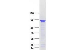Validation with Western Blot