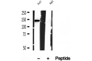 Western blot analysis of extracts of HepG2 cells, using IFT140 antibody. (IFT140 anticorps  (Internal Region))
