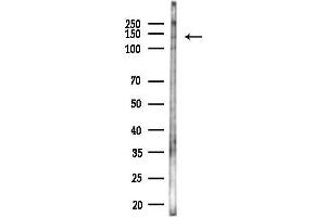 anti-REV1, Polymerase (DNA Directed) (REV1) (C-Term) antibody