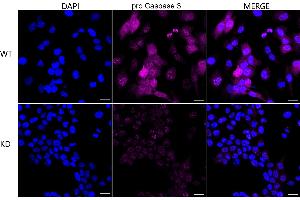 Immunocytochemical staining of HeLa cells using pro Caspase 3 antibody (ABIN7799900), 1:1,000), Top panel: wild-type (WT), Bottom panal: pro Caspase 3 shRNA knockdown (KD). (Recombinant Pro Caspase 3 anticorps)