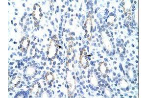 Image no. 1 for anti-General Transcription Factor II I Repeat Domain-Containing 1 (GTF2IRD1) (AA 873-922) antibody (ABIN203344)
