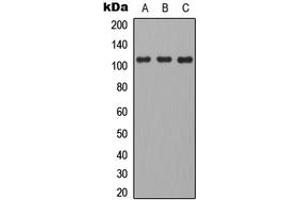 Western blot analysis of CD101 expression in HEK293T (A), mouse brain (B), H9C2 (C) whole cell lysates. (CD101 anticorps  (Center))