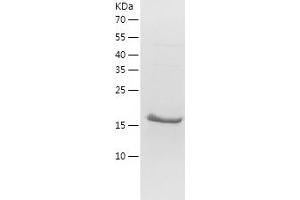 Western Blotting (WB) image for Tumor Necrosis Factor Receptor Superfamily, Member 11b (TNFRSF11B) (AA 201-401) protein (His-IF2DI Tag) (ABIN7125547)