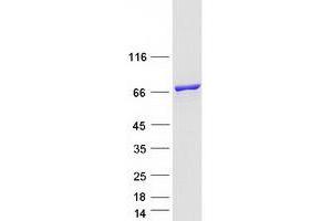 Validation with Western Blot