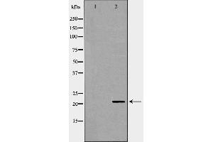 Western blot analysis of Hela whole cell lysates, using DHFR Antibody. (Dihydrofolate Reductase anticorps)