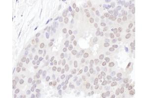 Immunohistochemistry (IHC) image for anti-YLP Motif Containing 1 (YLPM1) (AA 1350-1400) antibody (ABIN7455004) (YLPM1 anticorps  (AA 1350-1400))