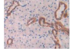 IHC-P analysis of Rat Kidney Tissue, with DAB staining. (Cathepsin D anticorps  (AA 120-407))