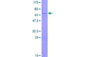 Image no. 1 for TBC1 Domain Family, Member 3 (TBC1D3) (AA 1-291) protein (GST tag) (ABIN1322222)