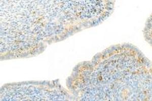 Immunohistochemistry analysis of paraffin-embedded mouse uterus using,NRK (ABIN7074842) at dilution of 1: 1500
