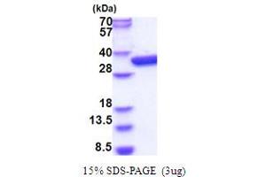 SDS-PAGE (SDS) image for Mitogen-Activated Protein Kinase Kinase Kinase Kinase 3 (MAP4K3) (AA 1-321) protein (His tag) (ABIN5853875)