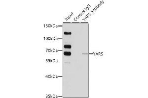 Immunoprecipitation analysis of 200 μg extracts of HeLa cells using 1 μg YARS antibody (ABIN6128883, ABIN6150324, ABIN6150325 and ABIN6222537).