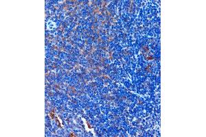 Immunohistochemistry of paraffin-embedded Mouse spleen using TCIRG1 Rabbit pAb (ABIN7270707) at dilution of 1:100 (40x lens).