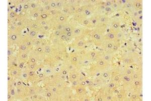 Immunohistochemistry of paraffin-embedded human liver tissue using ABIN7148439 at dilution of 1:100 (CRX anticorps  (AA 120-285))