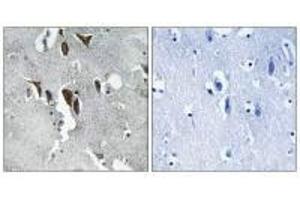 Immunohistochemistry analysis of paraffin-embedded human brain tissue using ELOVL5 antibody.
