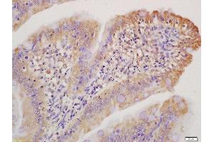 Formalin-fixed and paraffin embedded mouse intestine labeled with Anti-Collagen I Polyclonal Antibody, Unconjugated  at 1:200 followed by conjugation to the secondary antibody and DAB staining