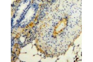 Used in DAB staining on fromalin fixed paraffin-embedded Lung tissue (JAM2 anticorps  (AA 74-250))